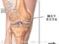 引起膝关节腔内出血的常见原因是什么？